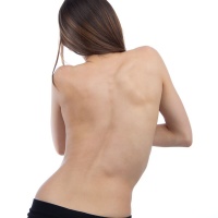 Scoliosis and Postural Distortion Image